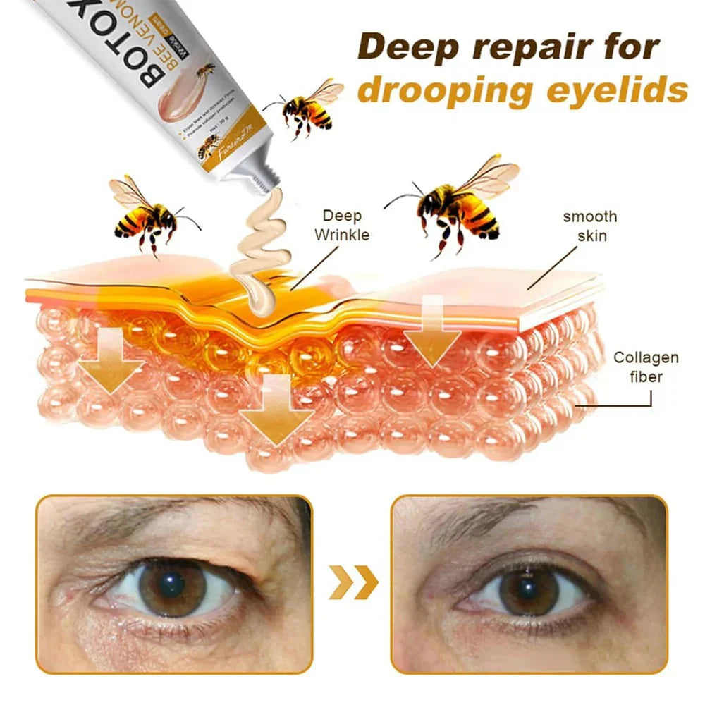 Botox Bee Venom